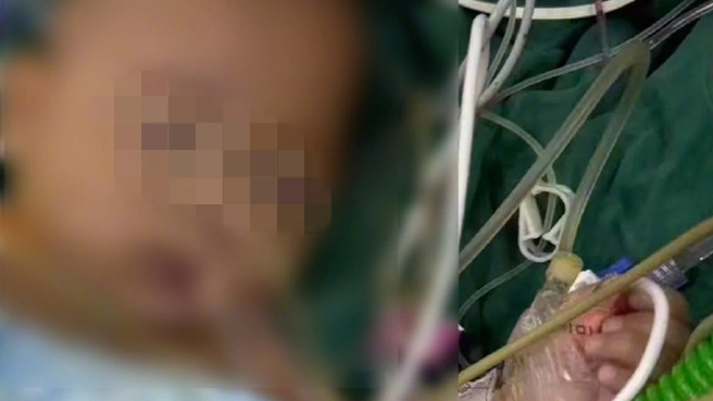 宁波5月龄早产儿术后离世，尸检报告曝光未缝合创口！真相究竟何时能来？